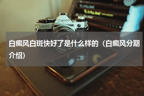 白癜风白斑快好了是什么样的（白癜风分期介绍）