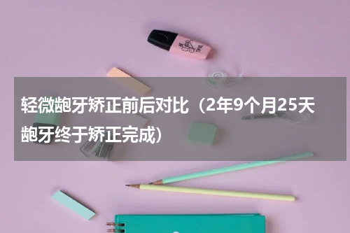 轻微龅牙矫正前后对比（2年9个月25天龅牙终于矫正完成）